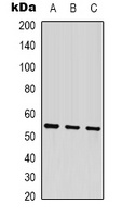 Beta-tubulin Mouse Monoclonal Antibody