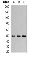 Beta3-tubulin Rabbit Polyclonal Antibody