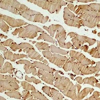 Beta3-tubulin Rabbit Polyclonal Antibody