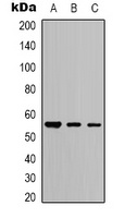Beta-tubulin Rabbit Polyclonal Antibody