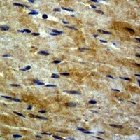 Beta-tubulin Rabbit Polyclonal Antibody