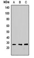 FGF2 Rabbit Polyclonal Antibody