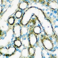 FGF2 Rabbit Polyclonal Antibody