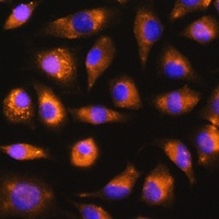 FGF2 Rabbit Polyclonal Antibody