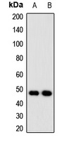 NUDT6 Rabbit Polyclonal Antibody