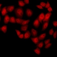 NUDT6 Rabbit Polyclonal Antibody