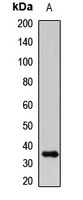 IGFBP2 Rabbit Polyclonal Antibody