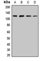 NEDD4 Rabbit Polyclonal Antibody