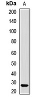 SMNDC1 Rabbit Polyclonal Antibody