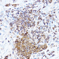 cIAP2 Rabbit Polyclonal Antibody