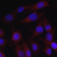 cIAP2 Rabbit Polyclonal Antibody