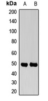 NGRH2 Rabbit Polyclonal Antibody