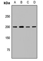 UBE2O Rabbit Polyclonal Antibody