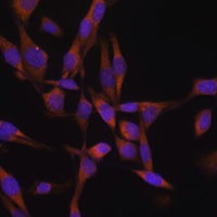 UBE2O Rabbit Polyclonal Antibody