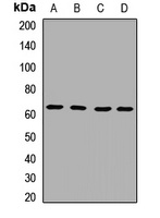 IL-1RL2 Rabbit Polyclonal Antibody