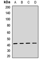TSLPR Rabbit Polyclonal Antibody