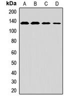 MAN2A1 Rabbit Polyclonal Antibody