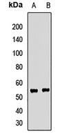 Septin 4 Rabbit Polyclonal Antibody