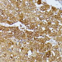 Septin 4 Rabbit Polyclonal Antibody