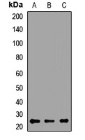TPD52 Rabbit Polyclonal Antibody