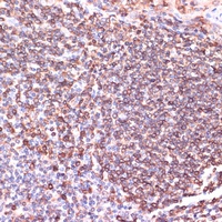 TPD52 Rabbit Polyclonal Antibody