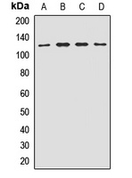 EIF3B Rabbit Polyclonal Antibody