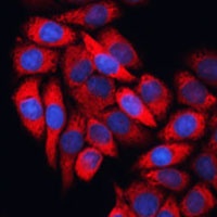EIF3B Rabbit Polyclonal Antibody