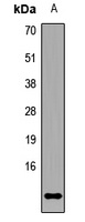 PAF15 Rabbit Polyclonal Antibody