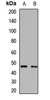 AADAC Rabbit Polyclonal Antibody