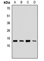 UBE2G2 Rabbit Polyclonal Antibody
