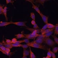 UBE2G2 Rabbit Polyclonal Antibody