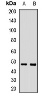 ZIP14 Rabbit Polyclonal Antibody