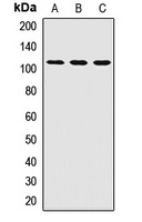 PEX6 Rabbit Polyclonal Antibody