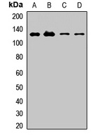 MEGF10 Rabbit Polyclonal Antibody