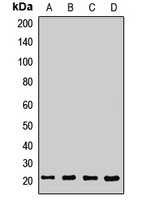 SEC11A Rabbit Polyclonal Antibody