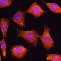 SEC11A Rabbit Polyclonal Antibody