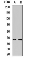 SEC14L2 Rabbit Polyclonal Antibody