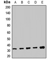 TRMT61A Rabbit Polyclonal Antibody