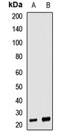 Neurotrophin 4 Rabbit Polyclonal Antibody