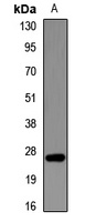 FAM3B Rabbit Polyclonal Antibody