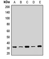 SDHB Rabbit Polyclonal Antibody