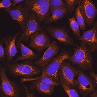 SDHB Rabbit Polyclonal Antibody
