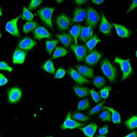 NGAL Rabbit Polyclonal Antibody