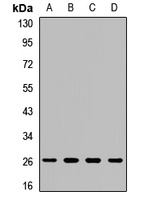 COX2 Rabbit Polyclonal Antibody
