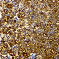CD282 Rabbit Polyclonal Antibody