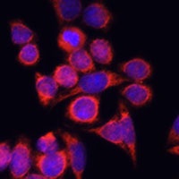 CD282 Rabbit Polyclonal Antibody