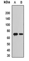 BACE1 Rabbit Polyclonal Antibody