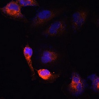 BACE1 Rabbit Polyclonal Antibody