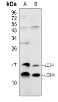 LC3-I/II Rabbit Polyclonal Antibody