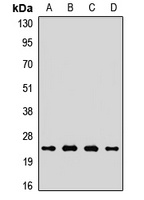 COX2 Rabbit Polyclonal Antibody